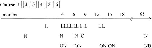 Fig. 4. Tumor failure data. / Time and site of tumor failure. L = local relapse only; N = new tumor sites alone; ON = old and new tumor sites involved; C = CNS relapse; NB = new site and BM involvement in relapse. The patient who was treated according to an ALL-type protocol and who experienced tumor progression (local and new sites) 10 months from diagnosis is not included.