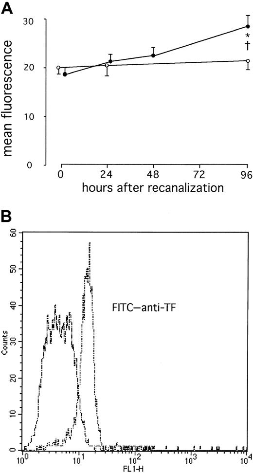Fig. 1. Increased TF surface expression on circulating monocytes after AMI. / (A) Serial changes in monocytic TF in patients with AMI (●) or in patients with stable angina (○). Values are expressed as mean ± SEM. *P = .02 compared to the values immediately after therapy. †P = .02 compared to the patients with stable angina. (B) Representative histograms from one patient with AMI at 96 hours (double dashes) and at 0 hours (dashes) are shown.