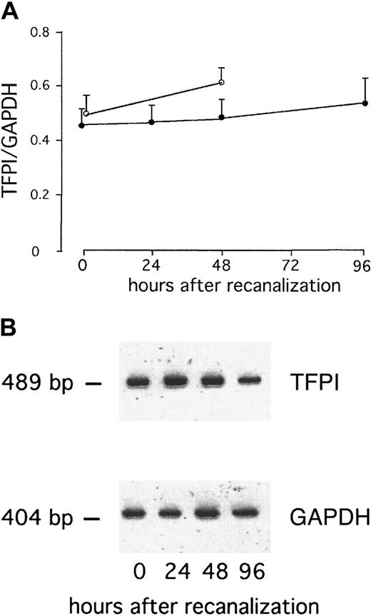 Fig. 4. TFPI RNA expression in whole blood after AMI remain unchanged. / (A) Serial changes in TFPI-1 RNA expression of whole blood in patients with AMI after direct stenting (●) or in patients with stable angina after elective stenting (○). Values are expressed as mean ± SEM. (B) RT-PCR products of one representative patient with AMI (B).