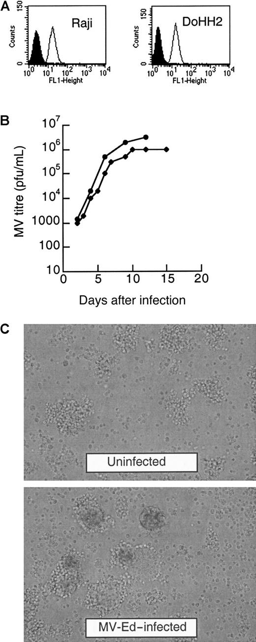 Fig. 1. DoHH2 and Raji lymphoma cell lines express CD46 and are lytically infected by MV-Ed and MVlacZ. / (A) Quantification of CD46 expression by fluorescence-activated cell sorter analysis by means of an anti-CD46 antibody and a secondary antibody conjugated to FITC. The shaded histograms represent cells incubated with isotype controls; the line histograms represent the fluorescence intensity of cells after incubation with anti-CD46 antibody. (B) Infection of DoHH2 and Raji cells in suspension culture with MVlacZ. The circles represent the titer on Raji cells; the diamonds represent the titer on DoHH2 cells. (C) Infection of Raji cells by MV-Ed results in a characteristic cytopathic effect, with the formation of multinucleated cells in suspension culture. Noninfected Raji cells are shown in comparison with MV-Ed–infected cells 4 days after infection.