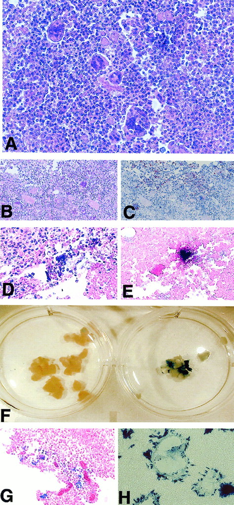 Fig. 4. Pathological analysis of MV-injected tumors shows the characteristic cytopathic effect of MV as demonstrated by anti–MV H staining, in situ hybridization for MV mRNA, and X-gal staining. / Replicating MV can be rescued from tumors up to 20 days after the final injection. (A) Hematoxylin and eosin staining of a section of Raji tumor showing multiple multinucleated syncytia. (B-C) Consecutive tissue sections stained with hematoxylin and eosin and with an anti–MV H antibody. Anti–MV H staining, which appears as brown staining upon a background of blue counterstain, is coincident with the MV-induced cytopathic effect. (D-E) Consecutive tissue sections stained with hematoxylin and eosin and subjected to in situ hybridization for MV N-specific mRNA. MV N mRNA appears as a dark brown–stained region upon a background counterstained pink with eosin. (F) Macroscopic X-gal–stained DoHH2 tumors injected with MVlacZ or control UV-inactivated MVlacZ. (G) A section from a DoHH2 tumor injected with MVlacZ and stained with X-gal. (H) X-gal–stained Vero cells 24 hours after coculture with a small tumor section. Large β-galactosidase–expressing syncytia are seen, a result of infection with replicating MVlacZ recovered from the tumor.