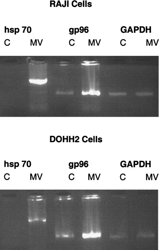 Fig. 6. Infection with MV induces expression of immunostimulatory hsps in DoHH2 and Raji cells. / Reverse transcriptase PCR for hsp70, gp96, and GAPDH 4 days after infection of DoHH2 and Raji cells with MV. C denotes control, uninfected cells. MV denotes MV-infected cells. Each pair of lanes is labeled with the specific primers used.