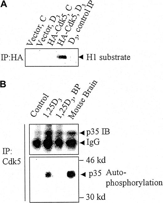 Fig. 2. p35Nck5a associates with and activates Cdk5 in differentiating HL60 cells. / (A) HL60 cells were transfected with an empty pCMV vector (“Vector”) or with a vector expressing hemagglutinin (HA)-tagged Cdk5, and either left untreated (C) or exposed to 10−7M 1,25D3 (D3) for 48 hours. The cell lysates were immunoprecipitated with an HA antibody and the immunoprecipitate incubated with histone H1 (H1) substrate under kinase assay conditions. The panel shows an autoradiogram for 32P-labeled histone H1 and demonstrates that transfected (HA tagged) Cdk5 becomes activated as a kinase in differentiating (1,25D3-treated) but not in undifferentiated HL60 cells. The lane marked “control IP” represents a control where the beads used for immunoprecipitation were not coated with the antibody. (B) Lysates of untreated HL60 cells. HL60 cells treated with 10−7M 1,25D3 for 48 hours and fresh whole mouse brain cell extract were immunoprecipitated (IP) with antibody to Cdk5. The lysates were incubated with γ32P-ATP in kinase assay buffer without an exogenous substrate then subjected to gel electrophoresis. The upper panel shows the immunoreactive p35 protein demonstrated by immunoblotting (IB), the lower panel the phosphorylation of the p35 protein by autoradiography for 32P. Mouse brain was used as a positive control of the previously reported autophosphorylation of p35Nck5a by neural cells. BP indicates a control in which the immunoprecipitating Cdk5 antibody was blocked with the immunizing peptide. The data illustrate 4 similar experiments.