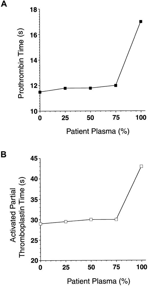 Fig. 1. Mixing patient plasma with normal plasma does not prolong clotting times. / Mixtures of patient plasma (0%, 50%, 75%, and 100% final) and normal plasma were incubated at 37°C for 1 hour. Prothrombin time (A) and activated partial thromboplastin time (B) in each sample were measured.