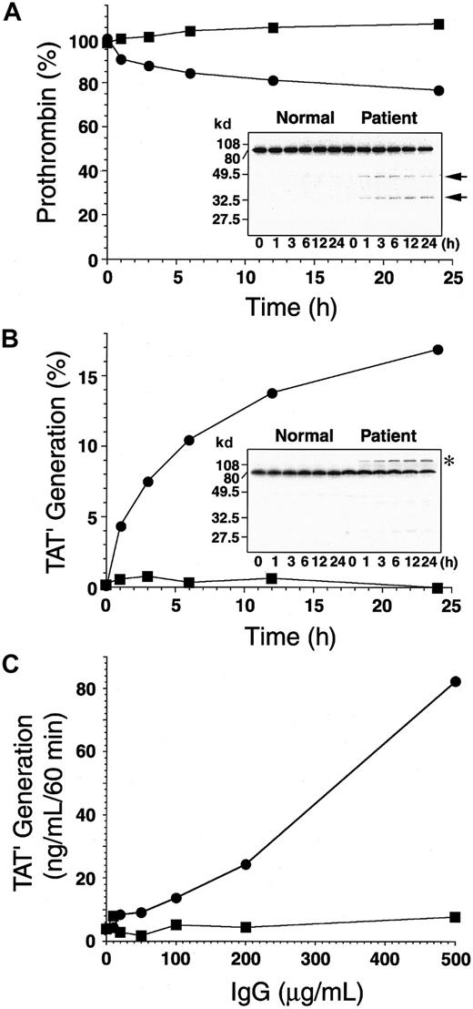 Fig. 3. Incubation of 125I-prothrombin with the autoantibody cleaves prothrombin in the absence of antithrombin III or makes a high-molecular-weight complex in the presence of antithrombin III. / (A) Nonlabeled (1 μM) and 125I-labeled prothrombin (10 nM) were incubated with 750 μg/mL normal (▪) or patient IgG (●) in the absence of antithrombin III at 37°C for 0 to 24 hours. Each sample was separated by 10% SDS-PAGE under reducing conditions, followed by autoradiography (inset). Percentage residual prothrombin at each time point was determined by counting the 72-kd band and total radioactivity of each lane. (B) Nonlabeled (1 μM) and125I-labeled prothrombin (10 nM) were incubated with 750 μg/mL normal (▪) or patient IgG (●) in the presence of 5 μM antithrombin III at 37°C for 0 to 24 hours. Each sample was separated by 10% SDS-PAGE under reducing conditions, followed by autoradiography (inset). TAT′ generation (asterisk) was determined by counting radioactivity and was expressed as the percentage of total radioactivity of each lane. (C) Prothrombin (1 μM) was incubated with 0 to 500 μg/mL normal (▪) or patient IgG (●) in the presence of 5 μM antithrombin III at 37°C for 3 hours. The amount of TAT′ complex generated in each sample was measured by ELISA for normal TAT.