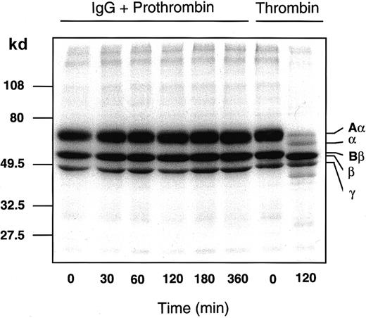 Fig. 5. Patient IgG-prothrombin complex does not convert125I-fibrinogen to 125I-fibrin. / Nonlabeled (30 μM) and 300 nM 125I-fibrinogen were incubated with a mixture of 750 μg/mL patient IgG and 1 μM purified prothrombin that had been preincubated at 4°C for 2 hours or with 10 NIH Us/mL α-thrombin, at 37°C for 0 to 360 minutes. Each sample was analyzed by 10% to 15% gradient SDS-PAGE under reducing conditions, followed by autoradiography.