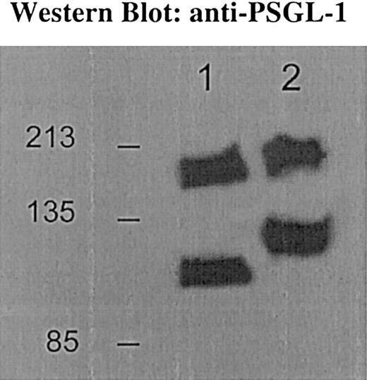 Fig. 3. Western blot for PSGL-1. / Bone marrow cells from control mice express PSGL-1 at 117 kd and 220 kd (lane 2); core 2−/− mice express PSGL-1 at 98 kd and 188 kd (lane 1) for the monomeric and dimeric form, respectively. PSGL-1 from core 2−/− neutrophils shows faster mobility compared with the control bands, consistent with absence of core 2 decoration on PSGL-1.