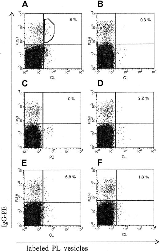 Fig. 2. Flow cytometry analysis of IgG-bearing B cells with labeled PL vesicles. / The percentage of double-positive cells is expressed as the percentage of IgG-binding B cells and is indicated in the upper right quadrant of each panel. (A) PBMCs from patient CIC: binding of labeled CL vesicles. (B) PBMCs from a healthy donor: binding of labeled CL vesicles. (C) PBMCs from patient CIC: binding of PC vesicles. (D-F) PBMCs from patient CIC: inhibition of labeled CL vesicle binding with, respectively, nonlabeled CL vesicles, nonlabeled PC vesicles, or antihuman Fab Ab. Single-cell sorting was performed in the gate of the double-stained population shown in the upper right quadrant in panel A. IgG-PE indicates IgG conjugated with R-phycoerythrin.