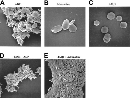 Fig. 8. Synergy between dimerized GPVI and Gi-coupled signals results in aggregation without shape change. / Scanning electron microscopy (original magnification × 8000) of wild-type platelets activated with ADP (5 μM) or adrenaline (10 μM) in the absence (A-B) or presence (D-E) of JAQ1 (10 μg/mL). (C) JAQ1 alone, like adrenaline, did not induce shape change or aggregation, whereas the combination of both results in large and densely packed aggregates of platelets that had only poorly changed their shape (extrusion of short pseudopods). ADP-induced aggregates increased in size and appeared more “clasped” in the presence of JAQ1.