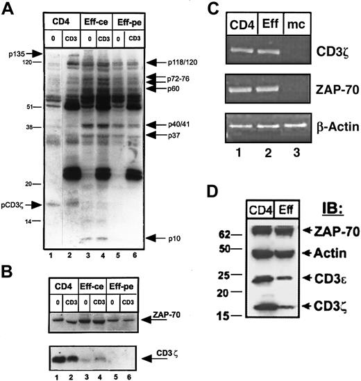 Fig. 3. Biochemical analysis of effector CD4 T cells reveals alterations in tyrosine phosphorylation and loss of CD3ζ and CD3ε protein expression. / Purified CD4 T cells from peripheral blood were used to generate effector cells using OKT3 antibody and autologous monocytes (see “Materials and methods”). CD4 cells and effectors were then left untreated (0) or cross-linked for 2 minutes with IgM anti-CD3 antibody (CD3) before lysis. Lysates from 106 CD4 T cells (lanes 1 and 2), and equivalent numbers of effector CD4 T cells (designated as ce, for cell equivalents, lanes 3 and 4), or equivalent levels of total effector cell protein (designated as pe, for 20μg protein equivalents, lanes 5 and 6) were resolved on reducing 12.0% SDS-PAGE, blotted to nitrocellulose, and probed sequentially with antiphosphotyrosine (A), followed by stripping and reprobing with anti-CD3ζ and anti–ZAP-70 antisera (B). These blots are representative results from 19 individual donors. In panel A, the effector-associated phosphorylated species of molecular weights 120/121, 76, 72, 60, 40/41, 37, and 10 kd are indicated on the right side of the blot. Bands of 135 kd and the phosphorylated CD3ζ band present in CD4 T-cell lysates, but not in effector T cells are indicated on the left side of the blot. (C) RT-PCR analysis of CD3ζ, ZAP-70, and actin transcript amplified from equal amounts of RNA isolated from resting CD4 T cells (CD4), effector CD4 T cells (Eff), and monocytes (mc). This gel is representative of 5 experiments. (D) Expression of ZAP-70, actin, CD3ε, and CD3ζ protein products in lysates of resting and effector CD4 T cells. Protein equivalents (4 μg/lane) from lysates of CD4 T cells or 5-day activated effector CD4 T cells purified as above were resolved by 4% to 20% gradient reducing SDS-PAGE, blotted to nitrocellulose, and blots were cut into strips and hybridized with polyclonal antiserum directed against ZAP-70, actin, CD3ε, and CD3ζ. IB indicates immunoblot.