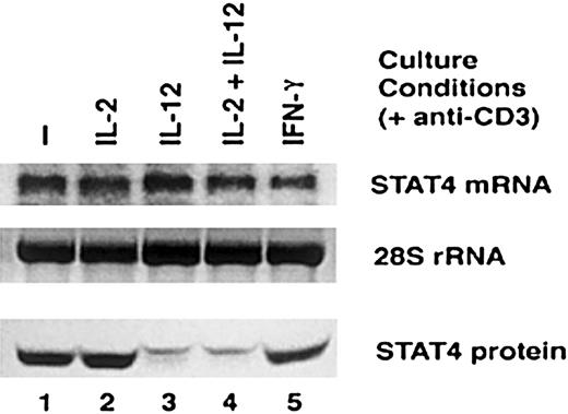 Fig. 5. Comparison of STAT4 mRNA and STAT4 protein expression after IL-12 activation. / Activated T cells were cultured with cytokines indicated in the presence of anti-CD3 for 24 hours. Whole-cell extracts and total RNA were prepared. Northern blot was probed with RT-PCR–amplified STAT4 cDNA fragment (top panel), and the 28S ribosomal RNA in the RNA gel was used as quantity control (middle panel). Western blots were performed with whole-cell extracts and probed with anti-STAT4 (bottom panel).