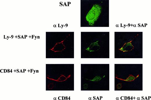 Fig. 6. Phosphorylated CD84 and Ly-9 associate with SAP at the plasma membrane. / To verify the results obtained with the yeast 2-hybrid system and immunoprecipitation in COS-7 cells, a fluorescence microscopy approach was used. COS-7 cells were transfected with SAP and Fyn along with CD84 or Ly-9. The cells were then stained for SAP and Ly-9 or CD84. Colocalization of SAP and Ly-9 or CD84 at the cell membrane can be visualized by yellow fluorescence where the 2 fluorochromes colocalize.