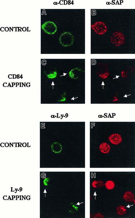 Fig. 7. CD84 and Ly-9 colocalize with SAP in Jurkat after activation of the receptors with monoclonal antibody. / A fluorescence microscopy approach was used in the human T-cell line Jurkat to confirm the SAP/Ly-9 and SAP/CD84 interaction in T cells. Jurkat cells were incubated with 5 μg/mL biotinylated anti-CD84 or anti-Ly9 antibody for 30 minutes at 4°C, as detailed in “Materials and methods.” Cells were then incubated with streptavidin-FITC and incubated at 4°C (control) or 10 minutes at 37°C (capping). Cells were then stained with Cy3-SAP, as indicated. Green fluorescence shows CD84 (A, C) or Ly 9 (E, G). Staining with red fluorescence indicates SAP (B, D, F, H). White arrows show colocalization.