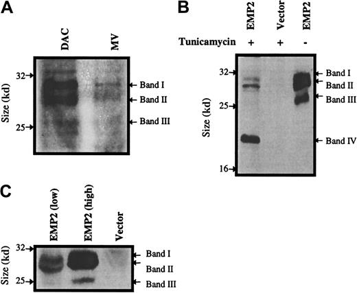 Fig. 2. Protein levels and glycosylation isoforms ofEMP2. / (A) DAC and MV cells were compared for EMP2 protein expression by Western blot using an anti-EMP2 rabbit serum. DAC cells express significantly higher levels of EMP2 than MV cells. (B) Effect of tunicamycin treatment on EMP2 protein. Cells were incubated with tunicamycin, and a Western blot was performed using an anti-Flag M2 antibody. Bands I-III designate glycosylated EMP2 isoforms; Band IV represents the nonglycosylated protein with the predicted molecular weight of 20 kDa. (C) NIH3T3 cells infected with the pSRαEMP2 expression vector express 3 size isoforms ofEMP2.
