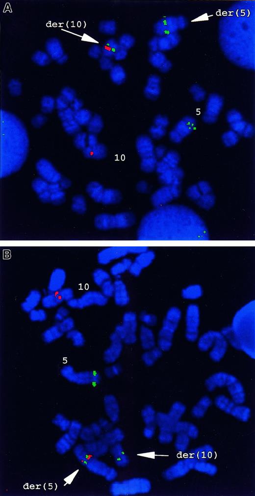 Fig. 1. FISH analysis of the t(5;10)(q33;q22) in primary patient cells. / (A) FISH analysis using PDGFβR- andH4-locus–specific probes. CosB, a PDGFβR-specific genomic probe, gave 3 hybridization signals on normal 5 and on der(5) and der(10) originating from t(5;10), respectively. Both YACs 781F5 and 876H2, for 10q21.3 to q22.1, hybridized with the normal chromosome 10 and with the der(5). No signals were present on der(10). (B) Dual-color FISH with CosB (red) and PAC29F6 (green) showed the presence of a fusion signal on der(5), whereas a green signal (PAC29F6) was present on the normal 10, and a red signal was seen (CosB) on the normal 5 and the der(10).