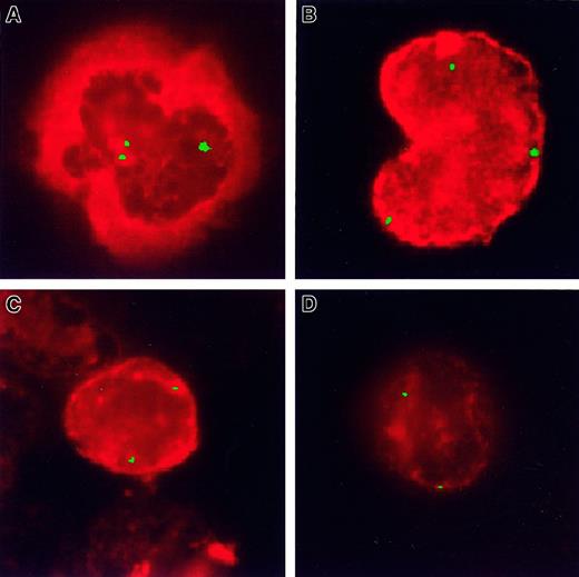 Fig. 2. Simultaneous phenotypic and genotypic analysis on a cytospin prepared from peripheral blood cells. / Monoclonal antibody (red), PDGFβR probe (green). (A, B) CosB gave 3 hybridization signals on CD13+ or CD14+ cells, respectively, indicating the presence of the t(5;10)(q33;q22) with a split PDGFβR signal in these myeloid lineage cells. (C, D) Only 2 signals were present in the CD3+ or CD19+ cells, respectively, indicating that these lymphoid cells lack the translocation.