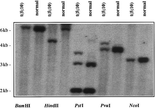 Fig. 3. Southern blot analysis of DNA from leukemia cells with t(5;10)(q33;q22). / Genomic DNA was isolated mononuclear cells from Ficoll-Hypaque density gradient sedimentation of peripheral blood from the patient and a normal donor and was digested (10 μg) with 5 different restriction endonucleases. The Southern blot was probed with a 1.1-kb (XhoI/HindIII) genomic PDGFβR probe. Rearrangements were evident in patient DNA when the restriction endonucleases HindIII, PstI, or PvuI were used (lanes 3-8).