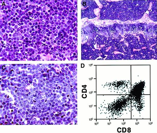 Fig. 6. Histopathologic and flow-cytometric analysis of mice transplanted with bone marrow transduced by H4/PDGFβR retrovirus. / Mice transplanted with bone marrow transduced with H4/PDGFβRretrovirus develop a lethal hematopoietic malignancy after a latency of approximately 150 days. The disease is characterized by proliferation of immature T cells (CD4+/+ and CD8+/+ cells), with infiltration of spleen (A, high-power view), bone marrow (B, low-power view), and lymph node (C, high-power view). Flow cytometry of the lymph node (D) demonstrates a predominant CD4+/+CD8+/+ T-cell population.
