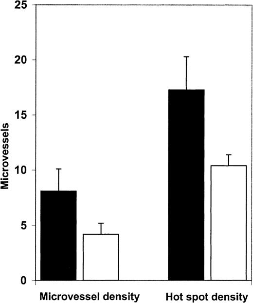 Fig. 5. Microvessel density and hot spot density in APL bone marrows at diagnosis and remission. / Microvessel density in bone marrow biopsy specimens obtained from patients (n = 7) in ATRA-induced remission (■, 4.2/hpf) was significantly decreased (P = .0063) compared with microvessel density (8.1/hpf) in diagnostic bone marrow biopsy samples from the same patients (▪). Hot spot density in bone marrow biopsy specimens from APL patients in ATRA-induced remission (10.4/hot spot) was also significantly (P = .0159) lower than hot spot density (17.3/hot spot) in their corresponding diagnostic bone marrow biopsy specimens.