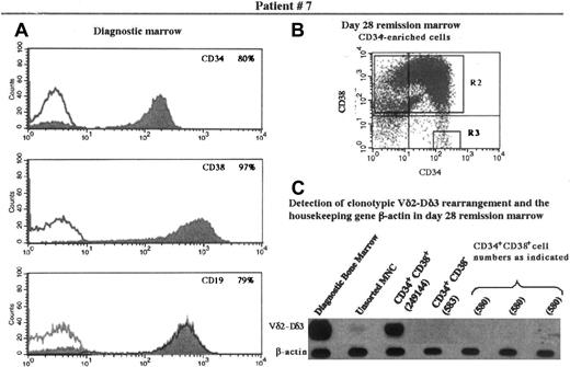 Fig. 1. Immunophenotype of diagnostic bone marrow and flow cytometric analysis of and detection of TCR rearrangement in the progenitor population of the remission marrow in patient 7. / (A) Expression of CD34, CD38, and CD19 in the diagnostic bone marrow. (B) The day 28 remission marrow was enriched for CD34+cells and analyzed for expression of CD34 and CD38. Quadrants containing cells expressing CD34+CD38+ and CD34+CD38− were designated as the sorting regions R2 and R3, respectively. (C) Cells fractionated into CD34+CD38+ and CD34+CD38− underwent PCR amplification and Southern hybridization, along with other controls as appropriate, for detection of the clonotypic Vδ2-Dδ3 rearrangement originally identified in this patient. The B-actin gene was used as a control for the presence of DNA in the fractions tested. MNC indicates mononuclear cells.