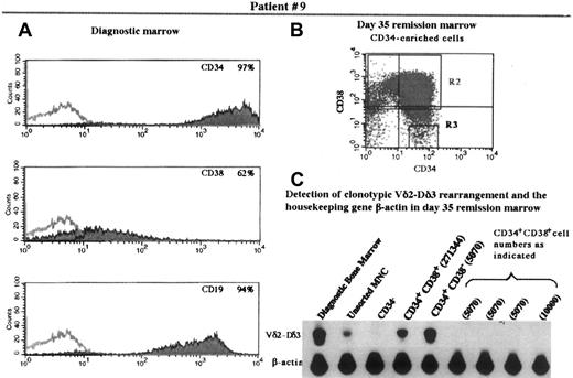 Fig. 3. Immunophenotype of diagnostic bone marrow and flow cytometric analysis of and detection of TCR rearrangement in the progenitor population of the remission marrow in patient 9. / Panels A, B, and C are as designated in Figure 1.