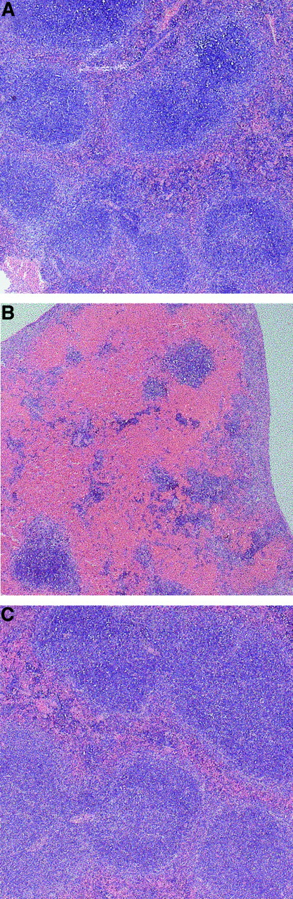 Fig. 2. Erythrocytes accumulate in the red pulp of spleens from anti-CD147–treated mice. / DBA2 mice were injected intraperitoneally with 100 μg RL73 F(ab′)2 (B) or Ter119 F(ab′)2 (C), or left untreated (A) and killed on day 3. Spleens were removed and fixed in 10% formaldehyde. Microtome sections were then stained with hematoxylin and eosin and analyzed by light microscopy (original magnification × 25).