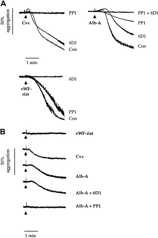 Fig. 1. Effects of 6D1 and PP1 on platelet agglutination/aggregation. / Human washed platelets (2 × 108/mL) (panel A) and Bernard-Soulier syndrome washed platelets (1.5 × 108/mL) (panel B) were preincubated for 5 minutes with vehicle (dimethyl sulfoxide 0.1%); anti-GPIbα mAb 6D1 (10 μg/mL); the Src family kinase inhibitor PP1 (10 μM); or mAb 6D1 and PP1 in combination. This was followed by stimulation with convulxin (Cvx; 1 μg/mL); alboaggregin-A (Alb-A; 1 μg/mL); and vWF ristocetin (vWF-rist; 10 μg/mL and 1 mg/mL, respectively). Experiments were conducted in aggregometer cuvettes with stirring at 37°C. Results are representative of 3 to 8 experiments.