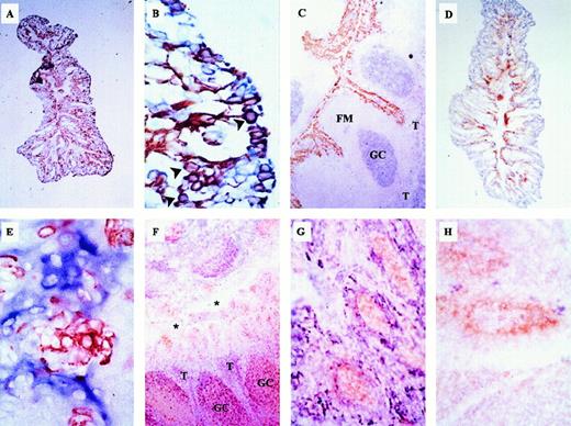 Fig. 1. Location of SDF-1–, MIP-3α–, and BCA-1–producing cells in the tonsil. / Frozen human tonsil sections were stained with the biotinylated anti–SDF-1 mAb (red) and anti–cytokeratin-19 (A,B) or anti-CD10 (C) mAbs (all shown in blue). SDF-1–expressing cells are found in the crypt (A,B) but not in the germinal center (GC), the follicular mantle (FM), or the T zone (T) in (C). The photomicrograph in panel B shows a higher-magnification view of the crypt seen in panel A. The section in panel D was stained with anti–MIP-3α (red) and anti–cytokeratin-19 (blue) Abs, while the section in panel E was double-stained with anti–SDF-1 (red) and anti–MIP-3α (blue) Abs. (F,G,H) Tonsil sections were double-stained with anti–BCA-1 (red) and anti-CD2 (F), anticytokeratin-19 (G) or anti-CD35 (H) (all in blue) Abs. BCA-1 is expressed by clusters of cells in the crypt and in the B-cell follicles (F). High-magnification views of the crypt show that BCA-1–expressing cells in this site do not express cytokeratin-19 (G) or CD35 (H). Magnifications are × 5 for panels A, C, D, and F; × 20 for panel G; × 40 for panel H; and × 100 for panels B and E. The stainings are representative of 5 different tonsil specimens. The arrow head indicates double positive cells; *, lumen of the crypt.