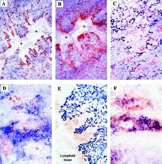 Fig. 2. Memory B cells closely interact with MIP-3α– and SDF-1–expressing cells and PCs with BCA-1–producing cells. / Tonsil sections were double-stained with anti–SDF-1 (A,C) or anti–MIP-3α (B,D) Abs and anti-CD19 (A,B; blue) or anti-IgG (C,D; red) Abs. SDF-1– and MIP-3α–producing cells are shown in red in panels A and B, respectively, and in blue in panels C and D, respectively. The section in panel E was double-stained with anti-CD38 (red) and anticytokeratin-19 (blue) mAbs and the section in panel F with anti–BCA-1 (red) and anti-CD27 (blue) Abs. PCs are located as clusters at the lymphoepithelial junction of the crypts (E). This site corresponds to the sites of the crypt BCA-1 expression (F). The stainings are representative of 4 different tonsil specimens. Original magnifications are × 20 for panels A, B, and E; × 40 for panels C, D, and F. * indicates lumen of the crypt.