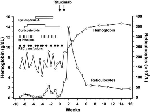 Fig. 1. Clinical course of the patient and response to treatment. / Reticulocyte count and hemoglobin levels are reported in the graph. Black circles represent red blood cell transfusion, tick marks represent immunoglobulin infusions, and rectangles treatment with corticosteroids and cyclosporine-A. Arrows show the 2 infusions of anti-CD20 monoclonal antibody.