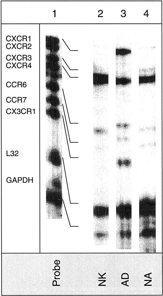 Fig. 2. Detection of mRNA for chemokine receptors in various NK cell subsets. / The hCR6 multitemplate kit, which detects mRNA for CXCR1, CXCR2, CXCR3, CXCR4, CCR6, CCR7, and CX3CR1, was used. Lane 1 shows mRNA of RNase-unprotected probes. Lanes 2, 3, and 4 show mRNA of protected probes in nonactivated (NK), adherent (AD), and nonadherent (NA) cells. Arrows indicate the presence of mRNA for the particular chemokine receptor.