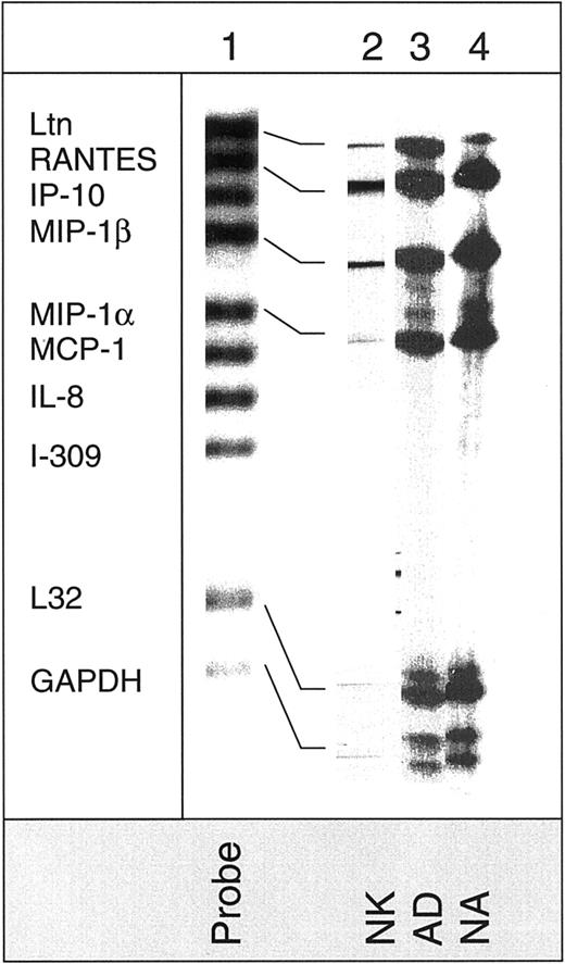 Fig. 8. Detection of chemokine mRNA expression in NK cells. / Expression of mRNA in nonactivated (NK), adherent (AD), and nonadherent (NA) cells was determined for various chemokines using the hCK5 multitemplate kit. The mRNA for these chemokines is examined: lymphotactin (Ltn), RANTES, IP-10, MIP-1α, MIP-1β, IL-8, MCP-1, and I-309.