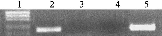 Fig. 1. hiwi is expressed in human CD34+ cells but not in CD34− hematopoietic cells. / Electrophoretic gel shows positive signal for hiwi in CD34+ sample and no signal in CD34− sample by semiquantitative RT-PCR. Lane 1, 123-bp DNA ladder; lane 2, CD34+ sample; lane 3, CD34− sample; lane 4, negative control (water) PCR reactions; lane 5, positive control (human testis, 269 bp).