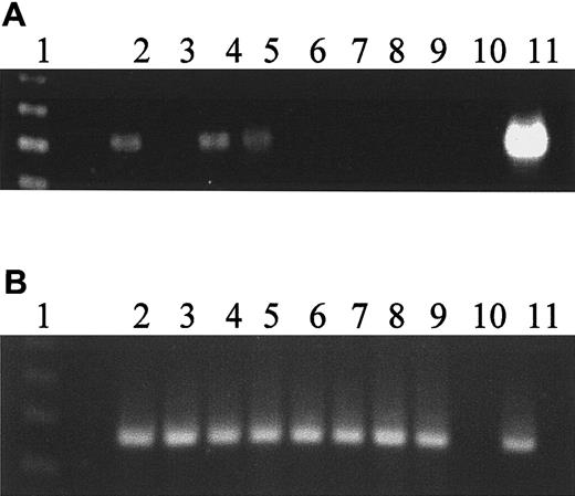 Fig. 3. Loss of. / hiwi expression during differentiation of CD34+ marrow cells. CD34+ cells were placed in suspension culture with G-CSF, IL-3, and SCF at 100 ng/mL added every 3 to 4 days. (A) Expression of hiwi as detected by semiquantitative RT-PCR. Lane 1, 123-bp DNA ladder; lane 2, day 0 CD34+ cells; lane 3, day 0 CD34−cells; lane 4, day 1 culture sample; lane 5, day 3 culture sample; lane 6, day 5 culture sample; lane 7, day 7 culture sample; lane 8, day 10 culture sample; lane 9, day 14 culture sample; lane 10, negative control (water); lane 11, positive control (human testis, 269 bp). (B) Internal control of β2-microglobulin gene expression throughout 14 days of culture (330 bp). Lane numberings correspond to the same samples as in panel A.