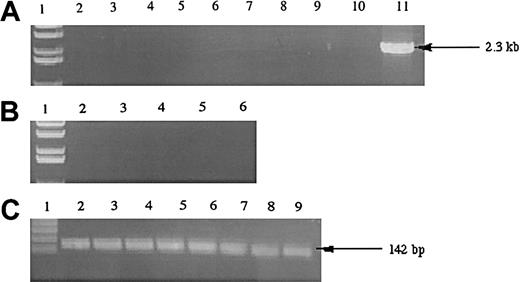 Fig. 4. Expression of. / hiwi in human leukemia cell lines. (A) Lane 1, 1-kb ladder; lane 2, TF-1; lane 3, Jurkat; lane 4, KG1a; lane 5, KG1; lane 6, K562; lane 7, CEM; lane 8, BV173; lane 9,SUPB13; lane 10, negative control (water); lane 11, human testis positive control (2.3 kb). (B) Samples without reverse transcriptase; same setup as panel A, excluding lanes 7 through 11 (samples 7-9 were donated cDNAs and total RNA samples were not available to perform the −RT control). (C) GAPD internal control (142 bp); lane numberings correspond to the same samples as in panel A, excluding lanes 10 and 11.