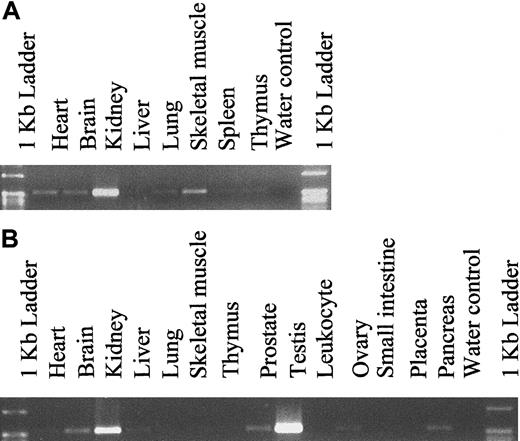 Fig. 5. Tissue distribution of hiwi mRNA. / (A) Human fetal tissues. (B) Human adult tissues (557 bp for both panels).