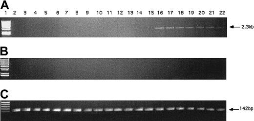 Fig. 8. PCR detection of hiwi DNA in transfected KG1 cells. / (A) PCR amplification of hiwi on mock transfected KG1 cells (d1-6, d9; lanes 2-8), empty vector transfected KG1 cells(d1-6, d9; lanes 9-15), and hiwi-containing vector-transfected KG1 cells (d1-6, d9; lanes 16-22). Lane 1 is a 1-kb DNA ladder. (B) Samples without reverse transcriptase; same setup as panel A. (C) GAPD internal control (142 bp), same setup as panel A.