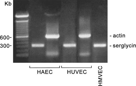 Fig. 1. Detection of serglycin mRNA in 3 types of endothelial cells. / The cell cultures, mRNA extractions, and RT-PCR reactions were carried out as described in the text. The PCR products were analyzed on 1% agarose gels in Tris/acetate/EDTA buffer. The markers are the 100-bp ladder (Bio-Rad).