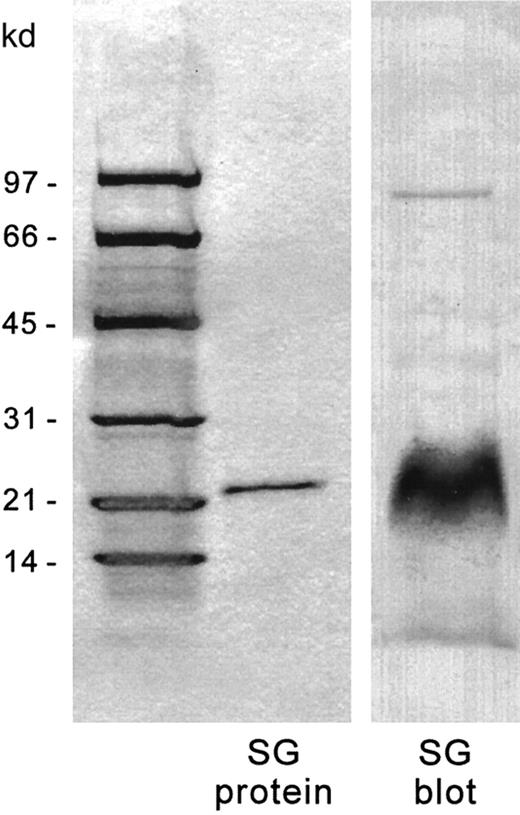 Fig. 5. Recombinant serglycin and immunoblotting by chicken antiserglycin IgY. / The recombinant serglycin was electrophoresed on 4% to 20% SDS-PAGE gradients and immunoblotted onto nitrocellulose. In each lane, 2 μg recombinant protein were applied. Left panel: Coomassie stain. Right panel: Immunostain.