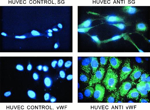 Fig. 9. Immunofluorescent staining of HUVECs with antiserglycin IgY and anti-vWF IgG. / Cells were prepared as described in the text. All cells were stained with DAPI to label the nuclei. The cells were labeled with either chicken antiserglycin or rabbit anti-vWF. Controls were, respectively, nonimmune IgY and normal rabbit serum. The cells and treatments are indicated in the figure. SG indicates serglycin.