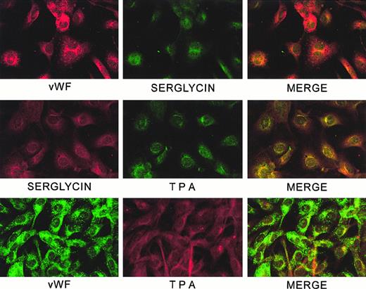 Fig. 10. Confocal analysis of localization of serglycin, vWF, and tPA in HUVECs. / Slides were prepared and examined by confocal microscopy as described in the text.