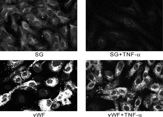 Fig. 11. Effect of TNF-α on secretion of serglycin and vWF from HUVECs. / Cells were treated as described in the text. Staining of TNF-α–treated cells was greatly reduced compared with controls.