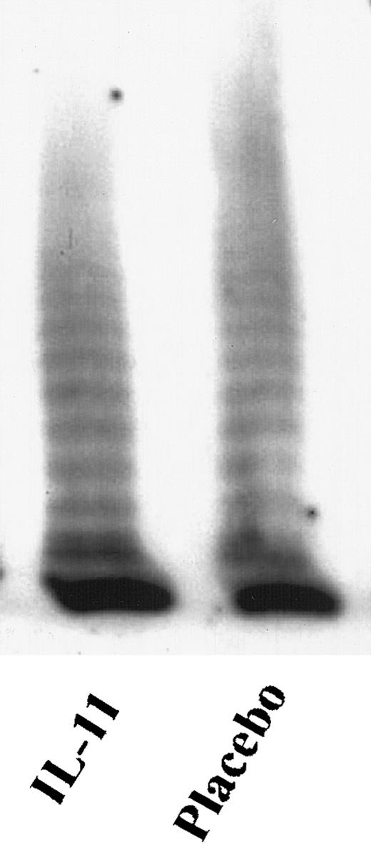 Fig. 2. Plasma vWf multimeric profile after rhIL-11 treatment. / Wild type mice were subcutaneously injected for 7 days with placebo or 250 μg/kg rhIL-11. The plasma was collected at the end of the injection period and layered on an SDS 1% agarose gel. vWf multimers were separated by discontinuous SDS/agarose gel electrophoresis and detected by incubation with 125I-labeled polyclonal antihuman vWf antibody. Autoradiograph of the gel is shown.