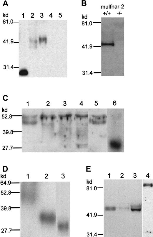 Fig. 4. Characterization of anti–muIfnar-2 antibodies and Western blot analysis of muIfnar-2 proteins. / (A) Western blot analysis. Recombinant muIfnar-2 proteins produced inE coli (450 ng; lane 1, muIfnar-2a), P pastoris(30 ng; lane 2, muIfnar-2 ECD), COS-7 cell culture supernatant (1 μL of a 1:10 dilution; lanes 3,4,5 muIfnar-2a, muIfnar-2c, and pEF-BOS vector control, respectively) were separated by SDS-PAGE under reducing conditions, transferred to Hybond C-extra membranes and incubated with anti–muIFNAR-2 antibodies as described in “Materials and methods.” (B) Western blots of serum from mice wild-type (+/+) and homozygous (−/−) for the muIfnar-2 gene. (C) Western blots of 1:20 diluted serum that were untreated (lane 1), or treated with 0.4 mU (lane 2), 0.8 mU (lane 3), 1.6 mU (lane 4) endoglycosidase F or 2.0 mU O-glycosidase (lane 5), and 150 ng E coli-derived recombinant muIfnar-2a as a reference (lane 6). (D) Western blots of 150 ng muIfnar-2 ECD untreated (lane 1), treated with 7.5 μU endoglycosidase H (lane 2), and recombinant muIfnar-2a (lane 3). (E) Western blots of normal adult mouse serum (lane 1, 1:20 dilution), mouse peritoneal wash (lane 2, 1:2 dilution), mouse urine (lane 3), and mouse mouth wash (lane 4).