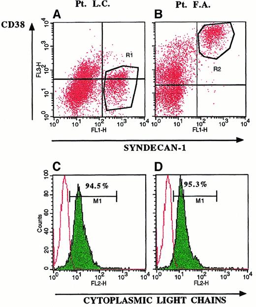 Fig. 1. Selective expression of syndecan-1 on myeloma cells. / Three-color fluorescence staining of BMMC in 2 representative patients with MM (Patient LC, panels A and C; and Patient FA, panels B and D) demonstrated expression of syndecan-1 on CD38− (A, R1 region) and CD38bright cells (B, R2 region). Gating of BMMC on syndecan-1+ cells (R1 and R2 regions) yielded the histograms shown in C and D. Expression of cytoplasmic monoclonal Ig (C,D) demonstrated that 95% of syndecan-1+/CD38− (R1 region) and syndecan-1+/CD38+ (R2 region) BMMC were myeloma cells.