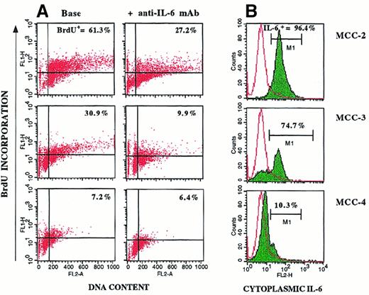 Fig. 6. Cytofluorometric profiles for 3 representative MCCs. / Shown are profiles for cell proliferation (A) and cytoplasmic IL-6 production (B). Cells were incubated in culture medium or the presence of 100 ng/mL anti–IL-6 mAb. Myeloma cell proliferation was evaluated by BrdU-PI cell incorporation. IL-6+ MCC-2 and MCC-3 (B) showed high percentages of spontaneous BrdU+ cells (A). Addition of anti–IL-6 mAb inhibited proliferation of MCC-2 and MCC-3, but had no effect on IL-6− MCC-4.