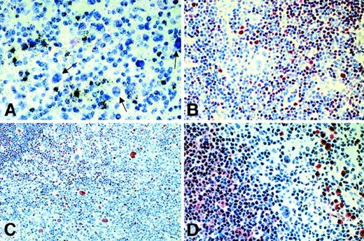 Fig. 2. Classical Hodgkin disease. / (A) Radioactive in situ hybridization with a probe specific for Oct2 mRNA. In contrast to bystander B cells, HRS cells remained completely unlabeled (arrows). (B) Immunostaining for Oct2. All HRS cells are unlabeled. (C) Immunostaining for Oct2. A proportion of HRS cells is positive. (D) Immunostaining for BOB.1/OBF.1. HRS cells are negative. All immunolabeling reactions were performed with the APAAP technique.