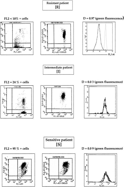 Fig. 4. One example of R, I, and S patients.