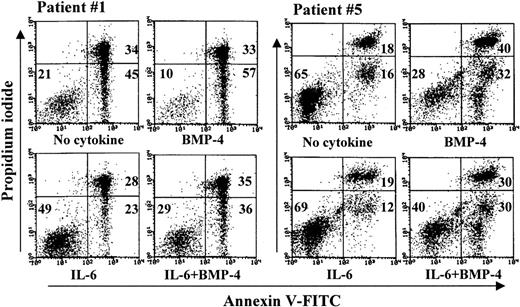 Fig. 7. BMP-4 induces apoptosis in samples of purified primary myeloma cells. / Primary myeloma cells from patients 1 and 5 were stimulated with 50 ng/mL BMP-4 1 ng/mL IL-6, or both, as indicated, and annexin V–FITC and PI binding were measured by flow cytometry. Numbers represent the percentage of cells in the respective quadrants. Cells in the lower left quadrant were considered viable, in the lower right quadrant apoptotic, and in the upper quadrants dead.