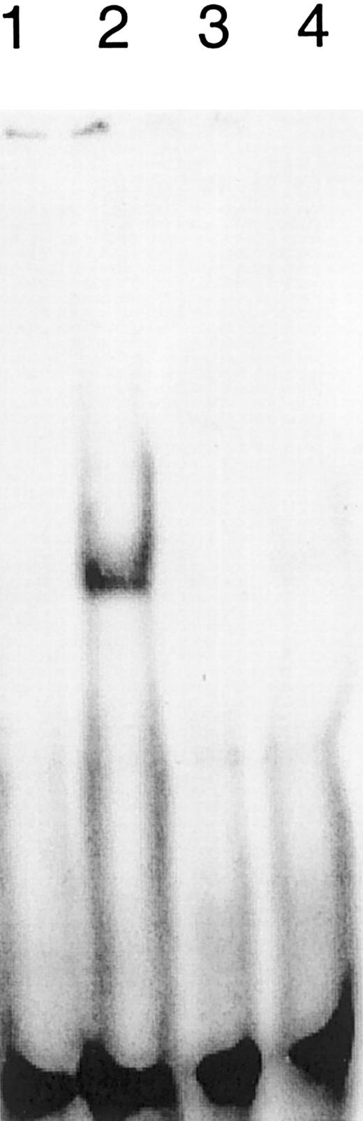Fig. 2. Impact of IFN-α on the binding of Stat factors to the SIE. / Nonmalignant CD4+ T cells (lanes 1 and 2) from patient R respond with the induction of DNA binding molecules to IFN stimulation (lane 2). The dominant Vβ CD4+ T-cell population from patient R (lanes 3 and 4) fails to induce DNA binding molecules on stimulation (lane 4). No IFN treatment (lanes 1 and 3); treatment with 500 U IFN-α for 30 minutes (lanes 2 and 4).